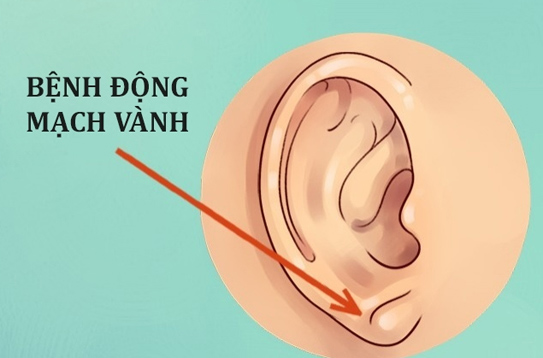Đừng xem thường, tai không chỉ để nghe và xem tướng mà còn chẩn bệnh được đấy - ảnh 3